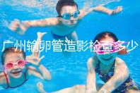 廣州輸卵管造影檢查多少錢,預(yù)約時間一次說清楚,想去看