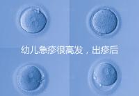 幼兒急疹很高發，出疹后的護理方法及注意事項提前知曉！