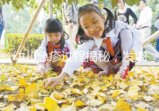 幼兒急疹過程揭秘，發(fā)燒規(guī)律和退疹時間全都有！