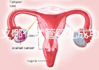 遵義哪個(gè)試管嬰兒成功率高？貴州生殖中心醫(yī)院2024年排名參考