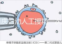 重慶婦幼人工授精一次成功率揭秘,移植費用貴有原因