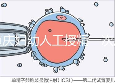 重慶婦幼人工授精一次成功率揭秘，移植費用貴有原因