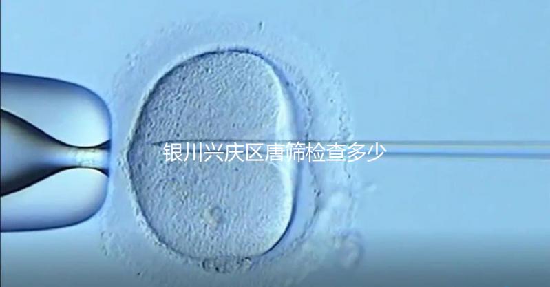 銀川興慶區唐篩檢查多少錢取決于情況，2024年國家免費限額