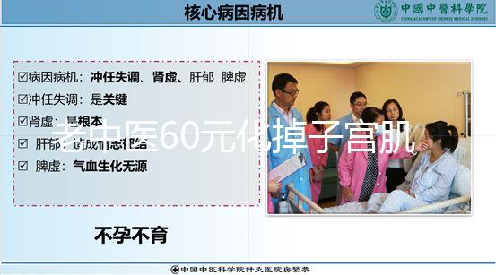 老中醫60元化掉子宮肌瘤偏方一覽，三棱效果怎樣用了就造