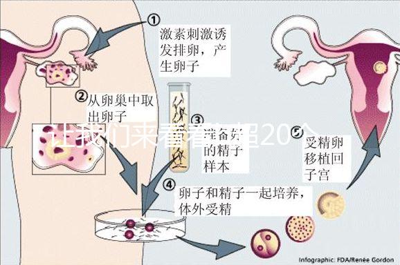 讓我們來看看b超20個卵子取10個是不正常的我們該怎么辦？