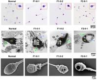 補充葉酸？elevit愛樂維那你不得不了解