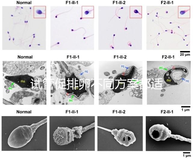 試管促排卵不同方案都適合哪些人？如何監(jiān)測(cè)排卵？