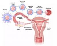 試管拮據劑方案(試管拮據劑方案是什么意思)