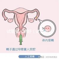 試管嬰兒哪好（試管嬰兒權威醫院哪家最好）