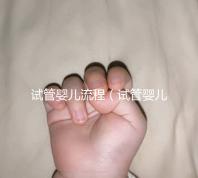 試管嬰兒流程(試管嬰兒流程八個(gè)詳細(xì)步驟)