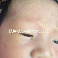 試管嬰兒壽命有多長(試管嬰兒壽命有多長時間)