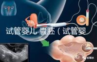 試管嬰兒 囊胚(試管嬰兒囊胚質(zhì)量等級)