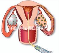 詳細說明去泰國杰特寧生殖中心做第三代試管技術的五大優勢,幫助你克服生育問題,快速隱藏!