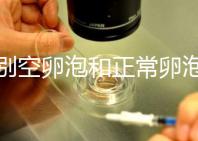 辨別空卵泡和正常卵泡是有技巧的,只需要了解這四個方面就可以輕松辨別,快速學習!