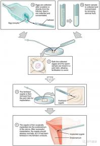 貴陽未婚子女戶口如何向婦女介紹，附2024年結算流程