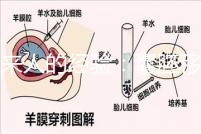 過來人的經(jīng)驗:囊胚移植第13天少量出血未必是壞事