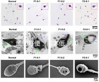 預(yù)約方便，成本低！2024年西安新城、臨潼、雁塔四維彩超指南