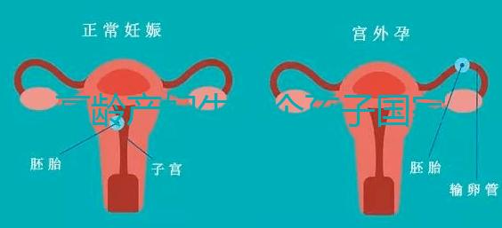 高齡產(chǎn)婦生八個(gè)孩子國(guó)家有補(bǔ)助?有沒有違法才是關(guān)鍵