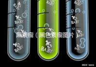 黑素瘤(黑色素瘤圖片)