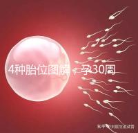 4種胎位圖解，孕30周這個姿勢最適合順產