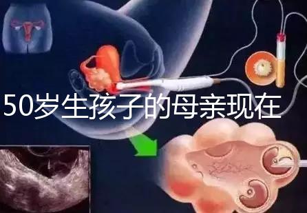 50歲生孩子的母親現(xiàn)在過(guò)得真不怎么樣,大齡不建議沖三胎