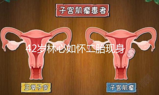 42歲林心如懷二胎現身新活動，霍建華全程陪同產檢回應