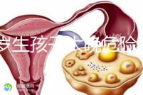 39歲生孩子太晚危險大別不care,進來聽聽生二胎真實感受