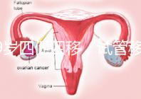 39歲四促四移,試管移植失敗5次后應(yīng)該怎么辦?