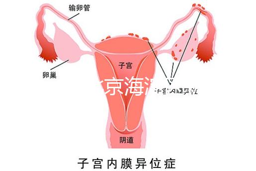 2024年北京海淀區(qū)新生兒醫(yī)療保險(xiǎn)處理策略,照片要求不要出錯(cuò)